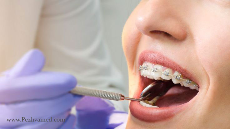 Best Orthodontist Specialists in Hollywood Fl