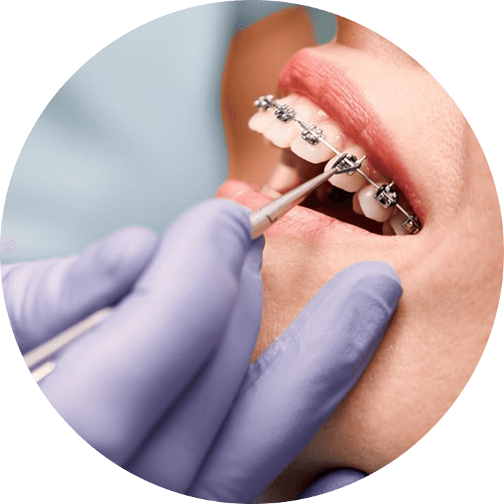 How to Navigate Orthodontic Choices in NYC Your Essential Guide 1